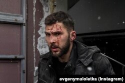 У такому стані одразу після вибуху Влада зняли журналісти