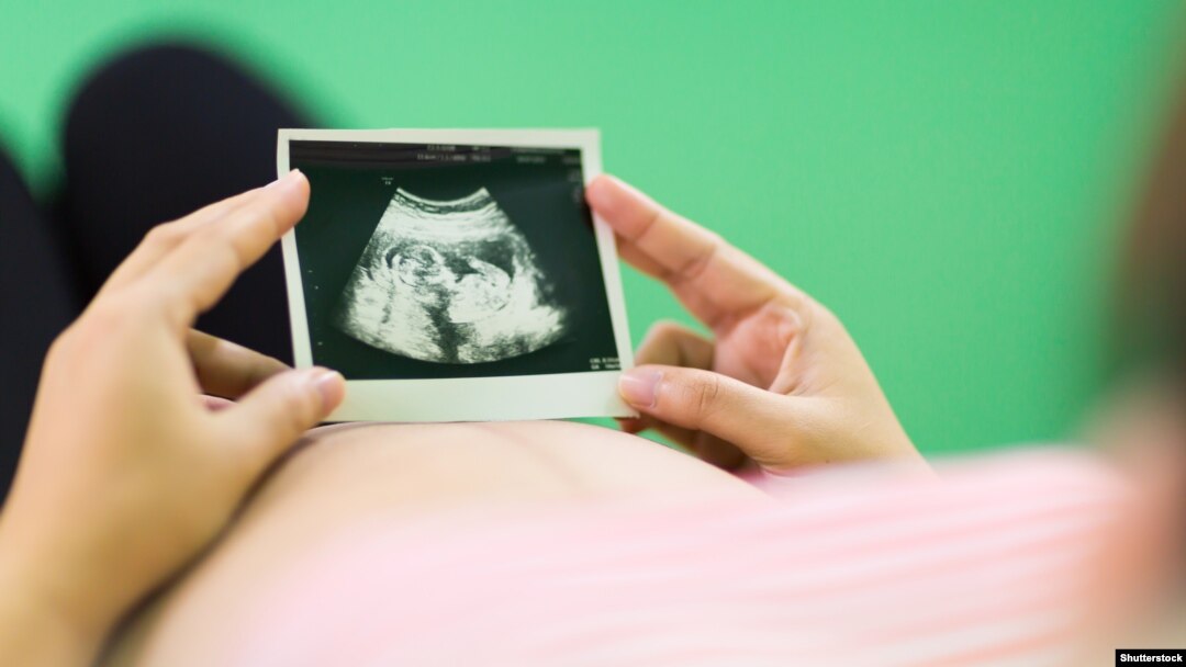 Žena gleda fotografiju bebe sa ultrazvuka, ilustrativna fotografija
